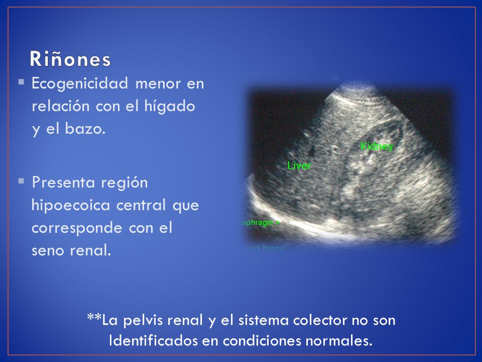 Riñones Ecogenicidad menor en relación con el hígado y el bazo.