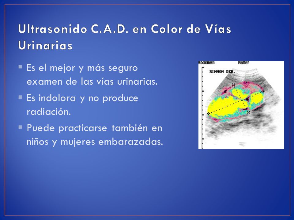 Ultrasonido C.A.D. en Color de Vías Urinarias
