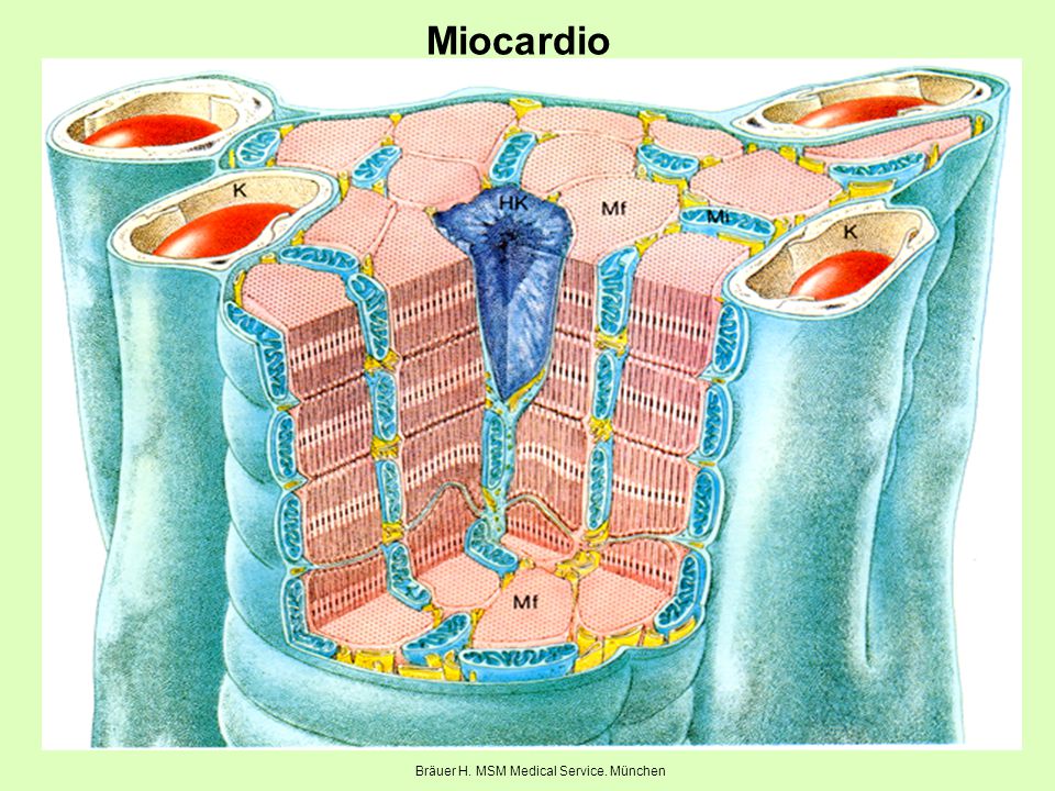 Miocardio Bräuer H. MSM Medical Service. München