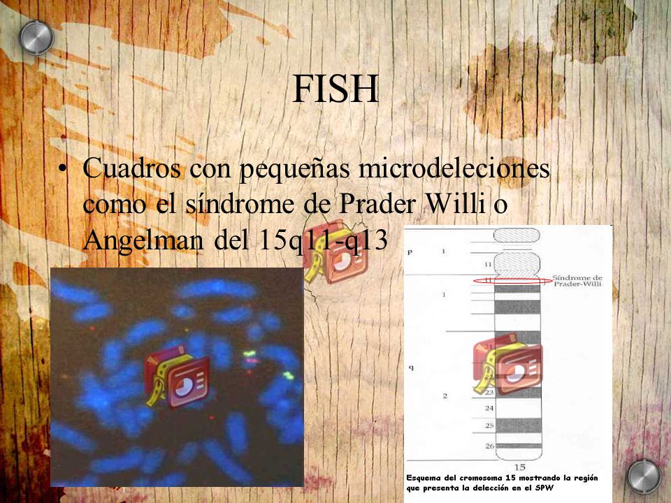 FISH Cuadros con pequeñas microdeleciones como el síndrome de Prader Willi o Angelman del 15q11-q13