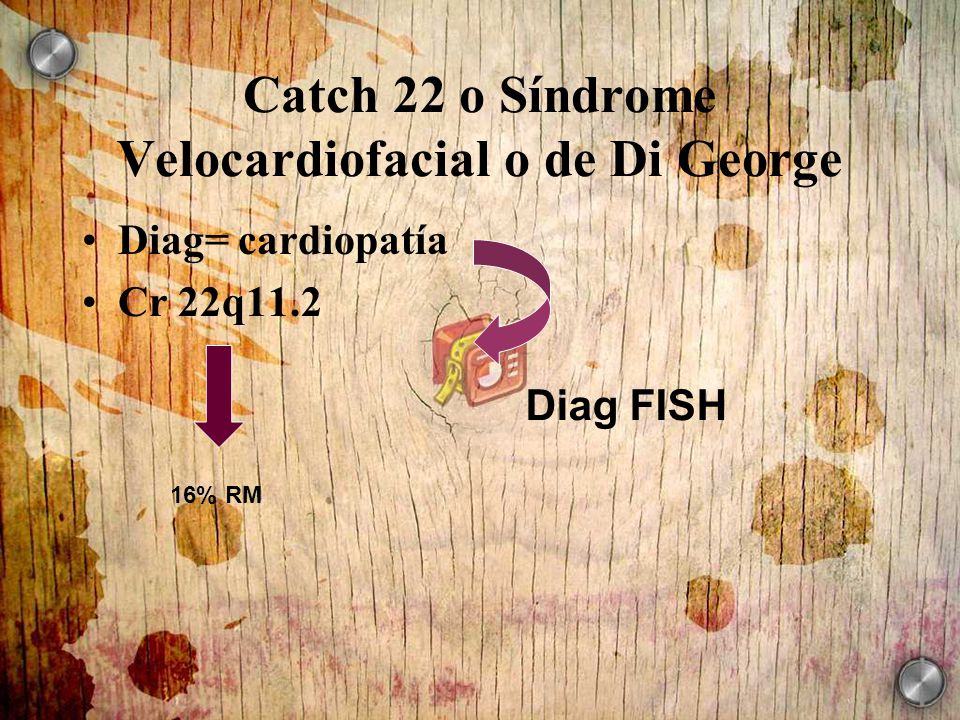 Catch 22 o Síndrome Velocardiofacial o de Di George