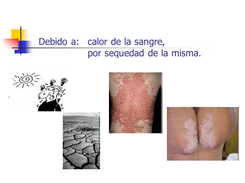 Debido a: calor de la sangre, por sequedad de la misma.
