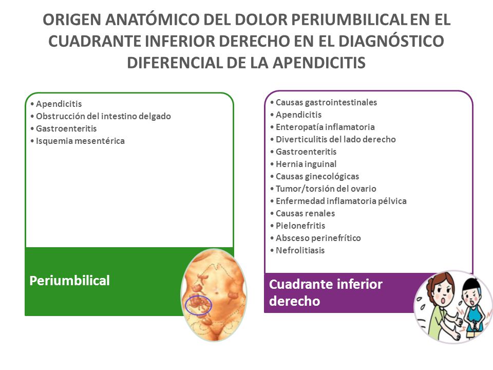 ORIGEN ANATÓMICO DEL DOLOR PERIUMBILICAL EN EL CUADRANTE INFERIOR DERECHO EN EL DIAGNÓSTICO DIFERENCIAL DE LA APENDICITIS
