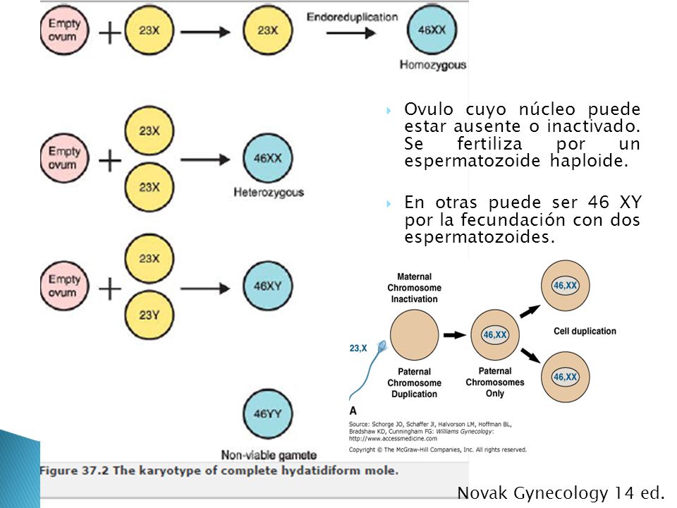 En otras puede ser 46 XY por la fecundación con dos espermatozoides.