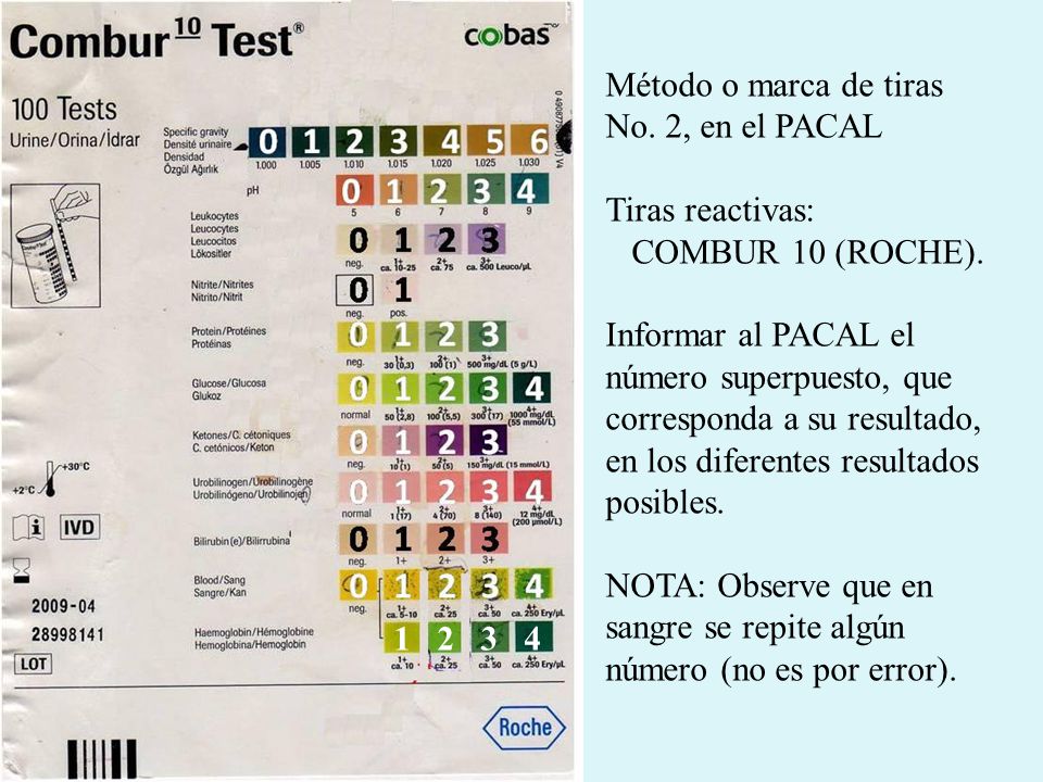 Método o marca de tiras No. 2, en el PACAL. Tiras reactivas: COMBUR 10 (ROCHE).