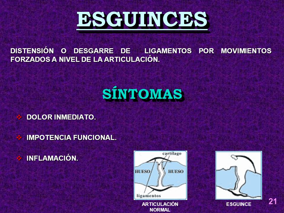 ESGUINCES DISTENSIÓN O DESGARRE DE LIGAMENTOS POR MOVIMIENTOS FORZADOS A NIVEL DE LA ARTICULACIÓN.