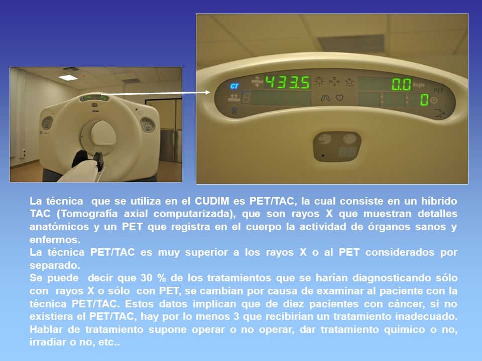 La técnica que se utiliza en el CUDIM es PET/TAC, la cual consiste en un híbrido TAC (Tomografía axial computarizada), que son rayos X que muestran detalles anatómicos y un PET que registra en el cuerpo la actividad de órganos sanos y enfermos.