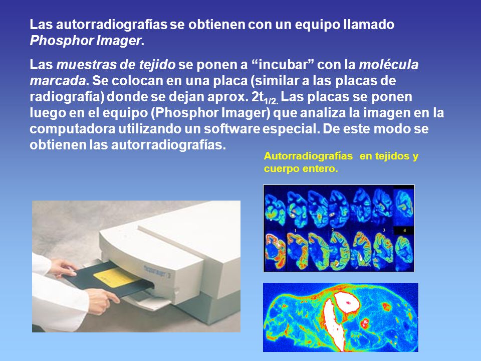 Las autorradiografías se obtienen con un equipo llamado Phosphor Imager.