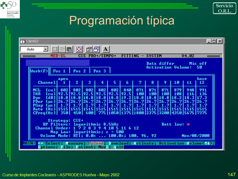 Programación típica Curso de Implantes Cocleares – ASPRODES Huelva – Mayo 2002
