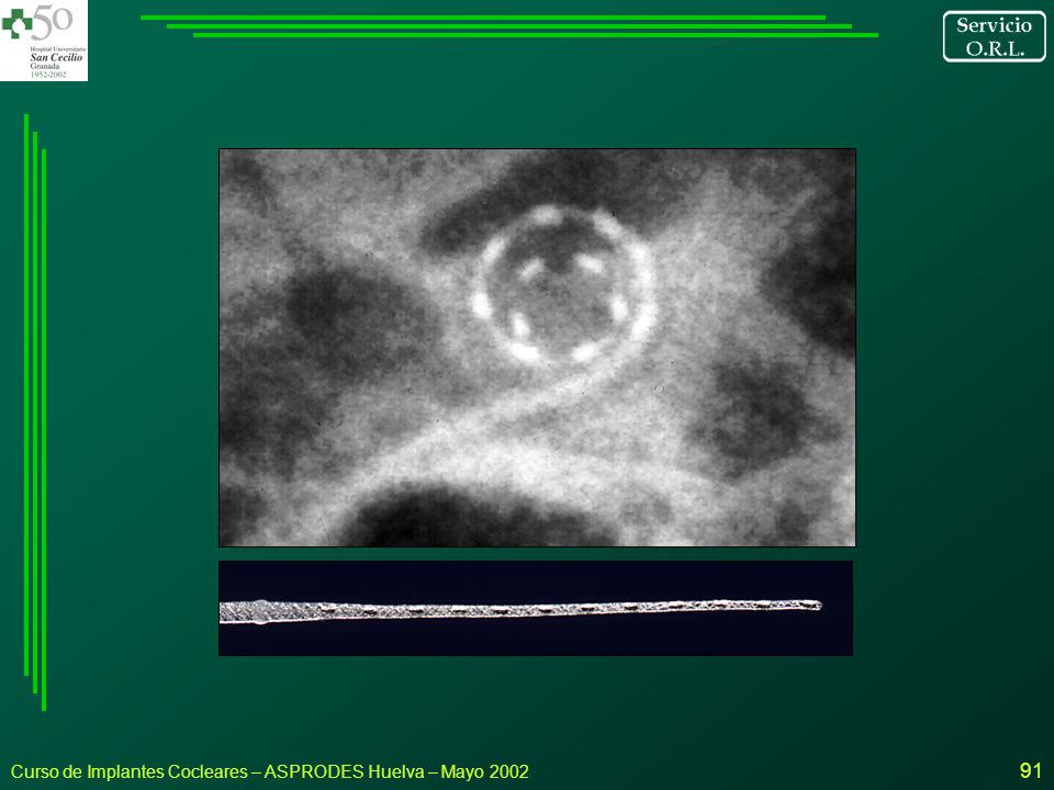 Curso de Implantes Cocleares – ASPRODES Huelva – Mayo 2002