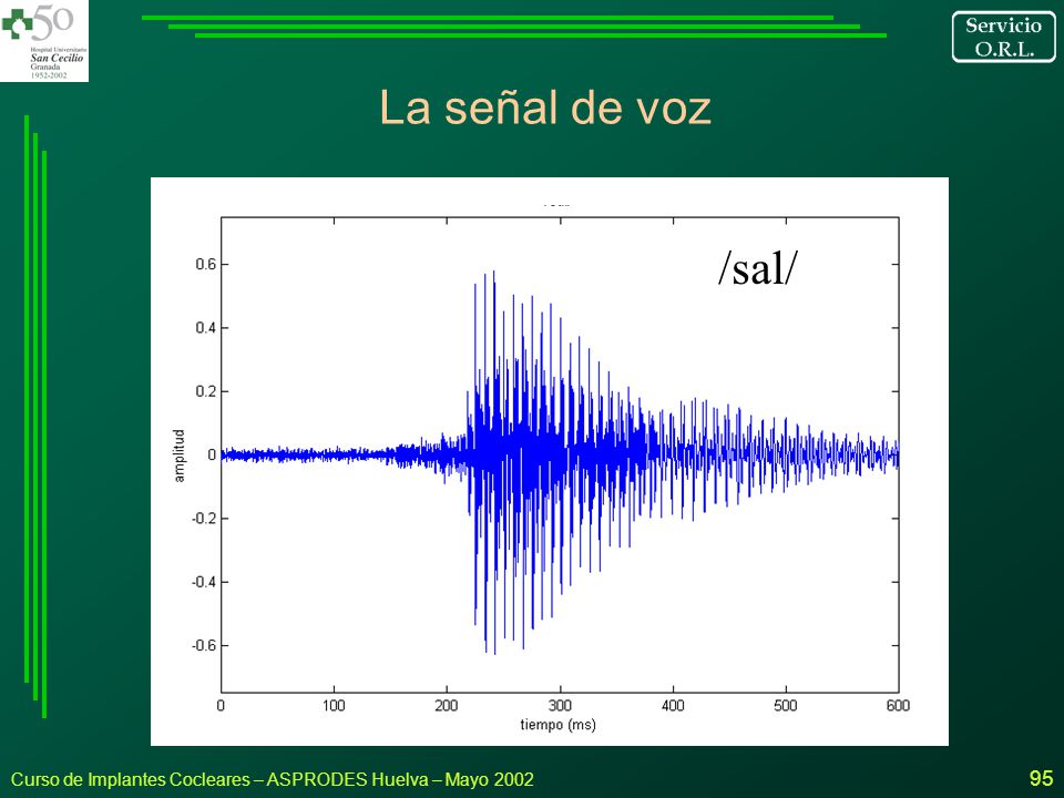La señal de voz /sal/ Curso de Implantes Cocleares – ASPRODES Huelva – Mayo 2002