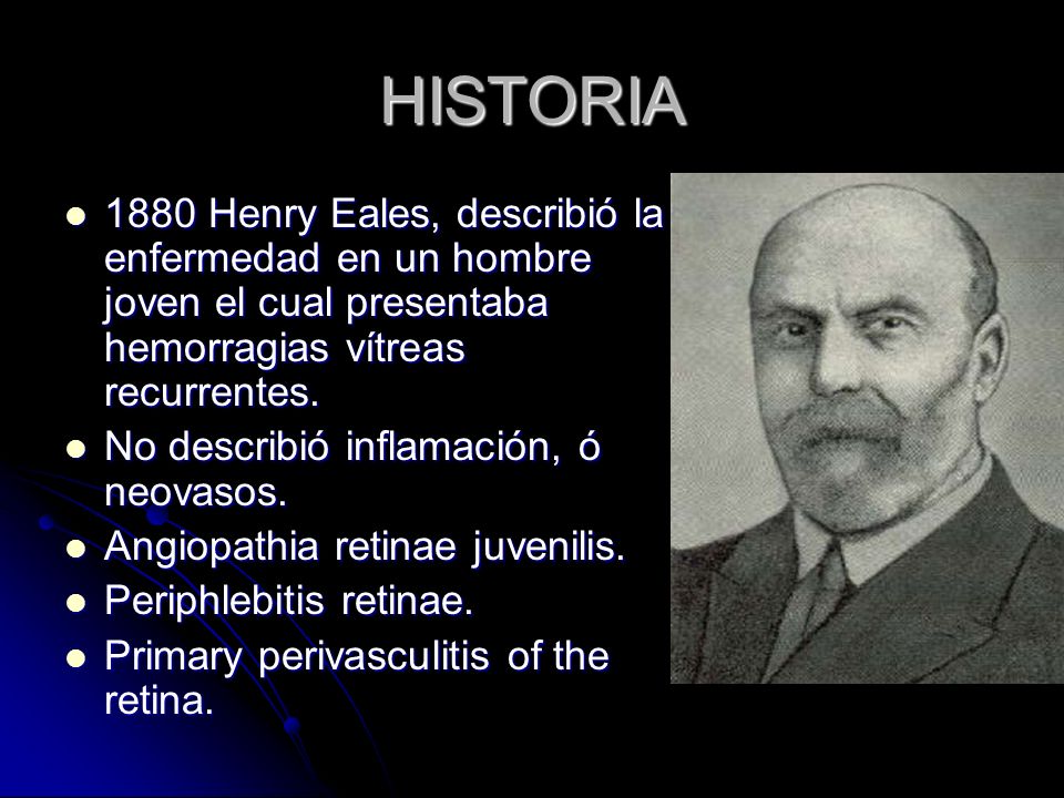 HISTORIA 1880 Henry Eales, describió la enfermedad en un hombre joven el cual presentaba hemorragias vítreas recurrentes.