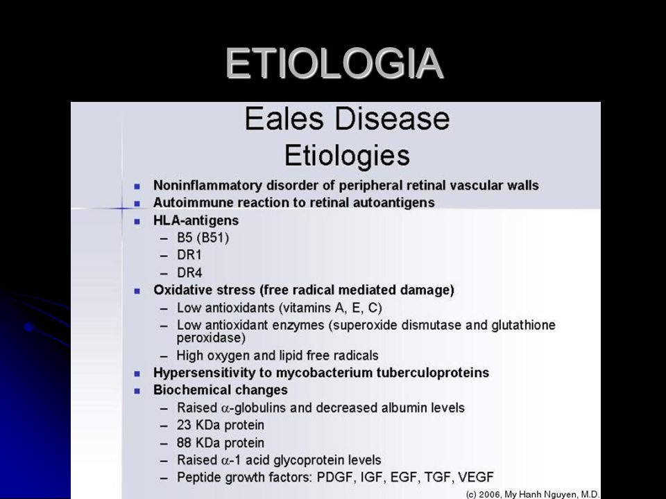 ETIOLOGIA HLA-B5 : Behcet estomatitis aftosa (úlceras o llagas en la boca), úlceras genitales y uveítis.
