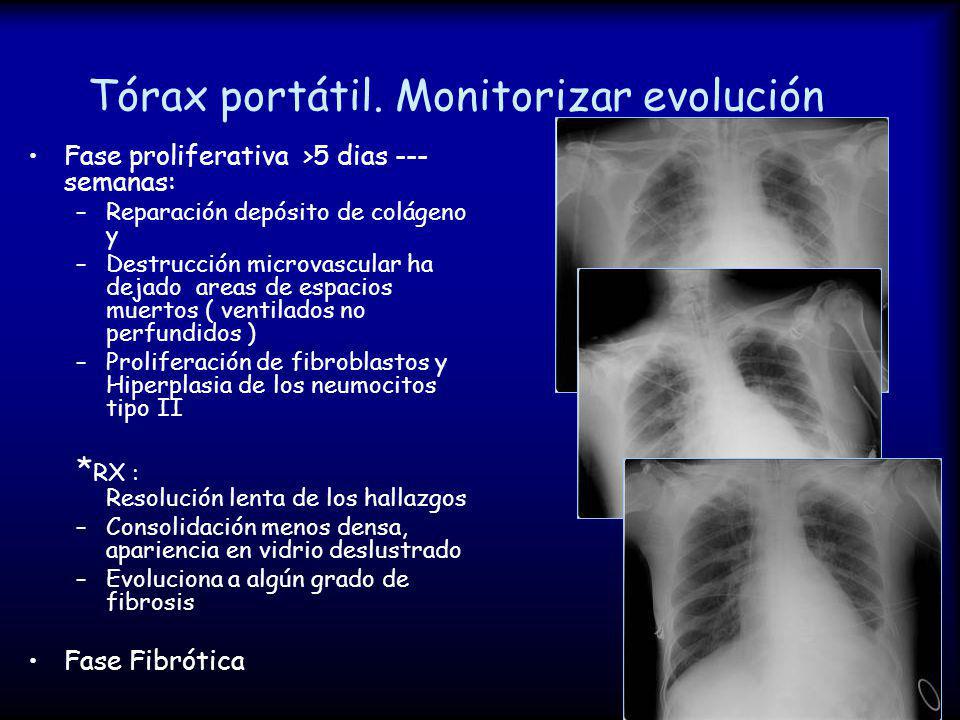 Tórax portátil. Monitorizar evolución