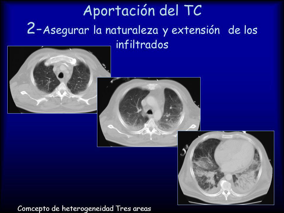 Aportación del TC 2-Asegurar la naturaleza y extensión de los infiltrados