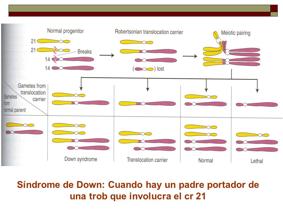 Síndrome de Down: Cuando hay un padre portador de una trob que involucra el cr 21