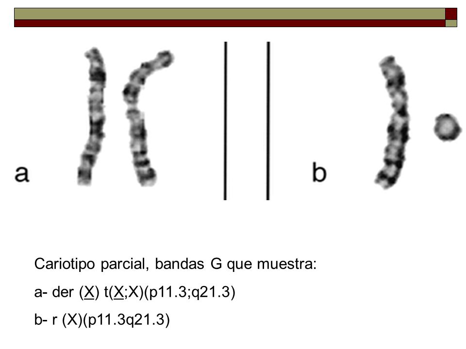 Cariotipo parcial, bandas G que muestra: