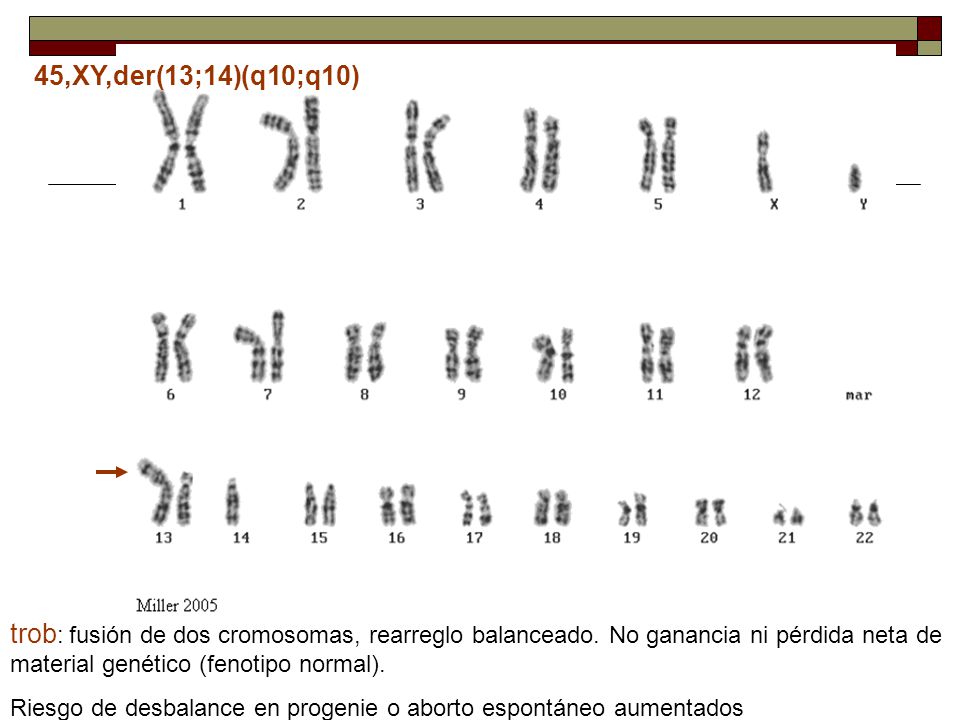 45,XY,der(13;14)(q10;q10) trob: fusión de dos cromosomas, rearreglo balanceado. No ganancia ni pérdida neta de material genético (fenotipo normal).