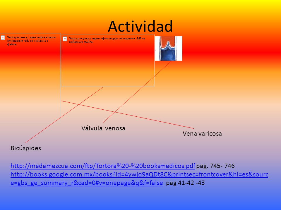 Actividad Válvula venosa Vena varicosa Bicúspides