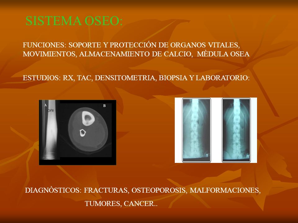 SISTEMA OSEO: FUNCIONES: SOPORTE Y PROTECCIÓN DE ORGANOS VITALES, MOVIMIENTOS, ALMACENAMIENTO DE CALCIO, MÈDULA OSEA.