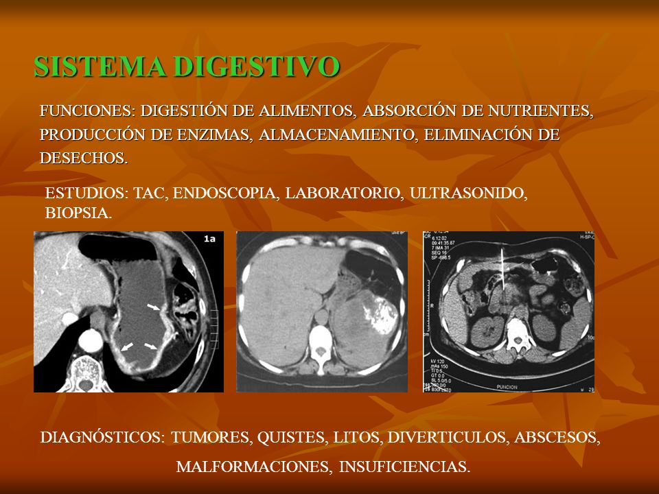 SISTEMA DIGESTIVO FUNCIONES: DIGESTIÓN DE ALIMENTOS, ABSORCIÓN DE NUTRIENTES, PRODUCCIÓN DE ENZIMAS, ALMACENAMIENTO, ELIMINACIÓN DE.