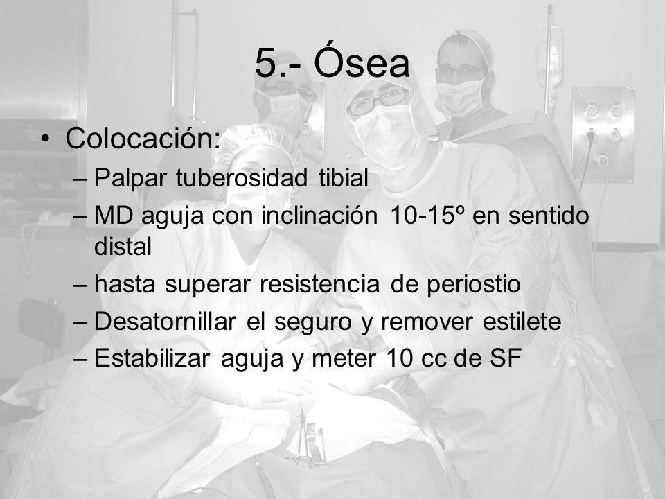 5.- Ósea Colocación: Palpar tuberosidad tibial