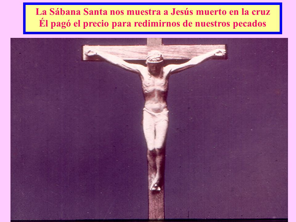 La Sábana Santa nos muestra a Jesús muerto en la cruz