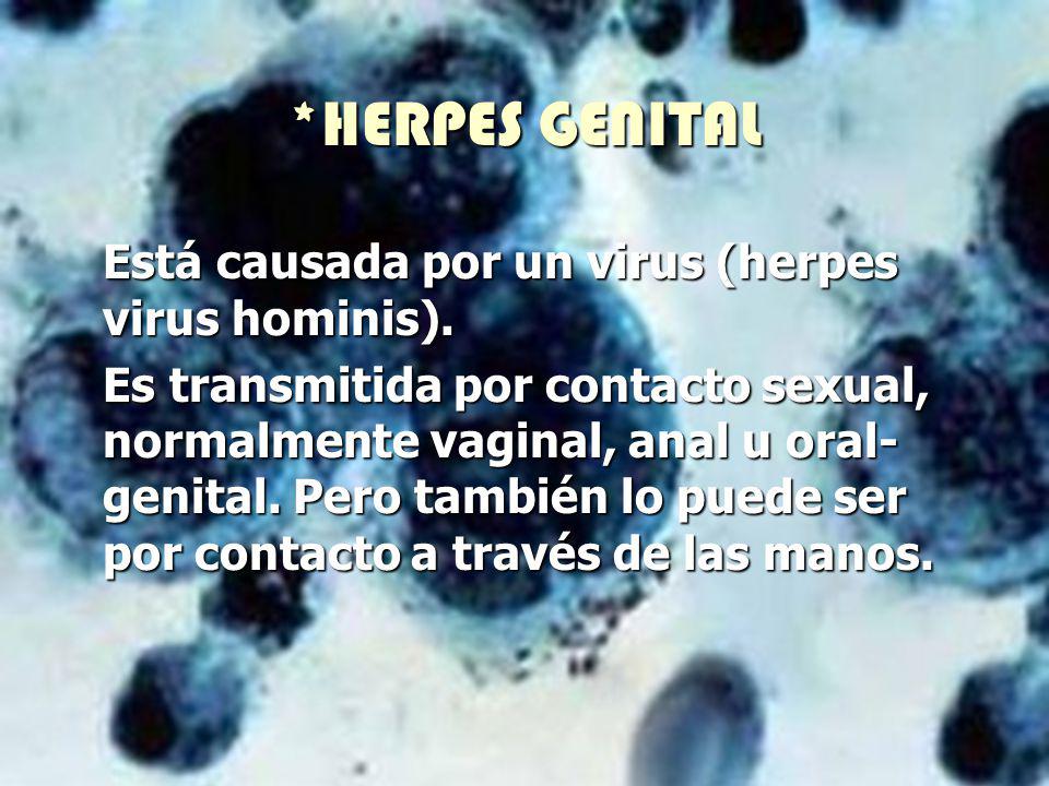 *HERPES GENITAL Está causada por un virus (herpes virus hominis).