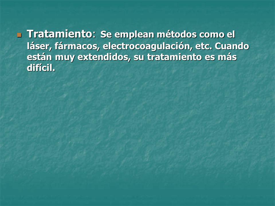 Tratamiento: Se emplean métodos como el láser, fármacos, electrocoagulación, etc.