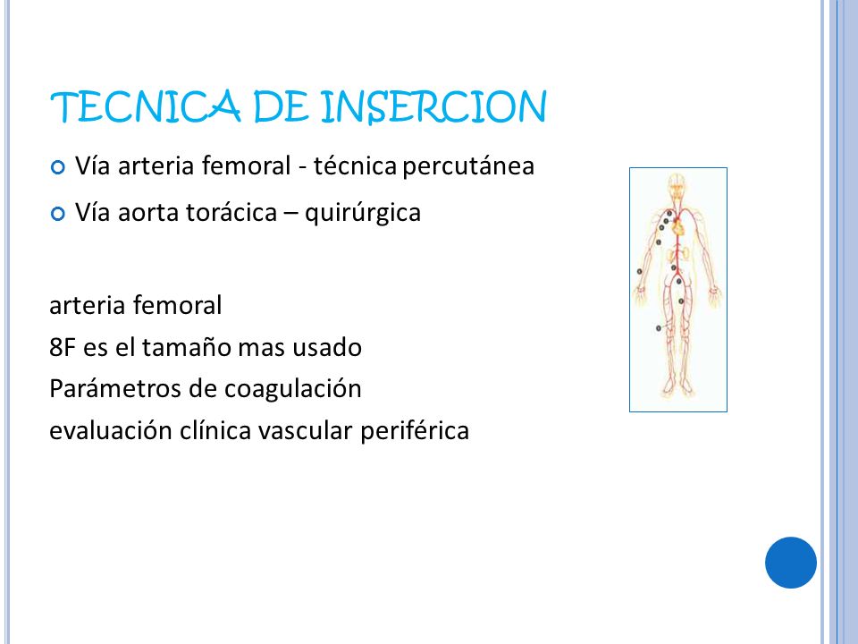 TECNICA DE INSERCION Vía arteria femoral - técnica percutánea