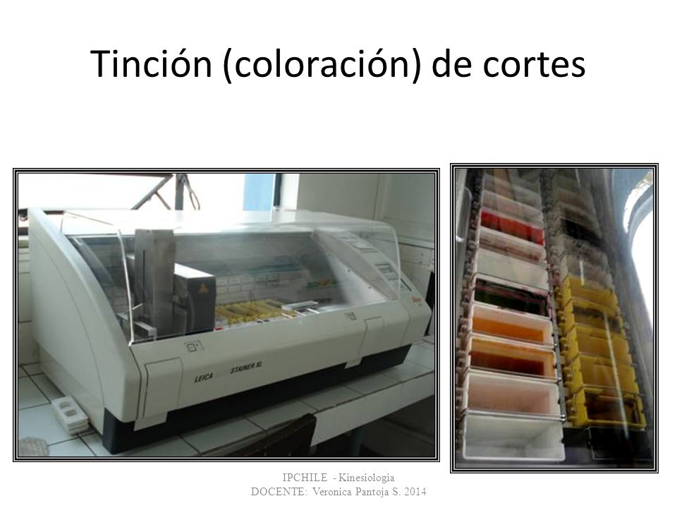 Tinción (coloración) de cortes