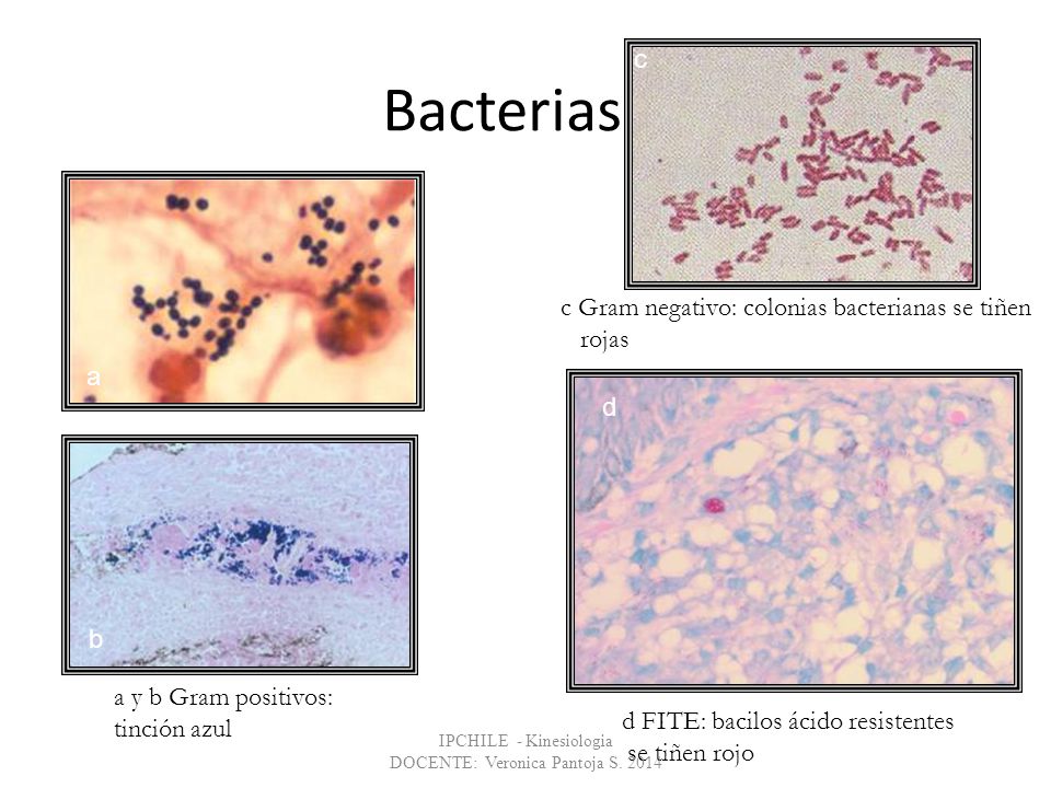 Bacterias c c Gram negativo: colonias bacterianas se tiñen rojas a d b