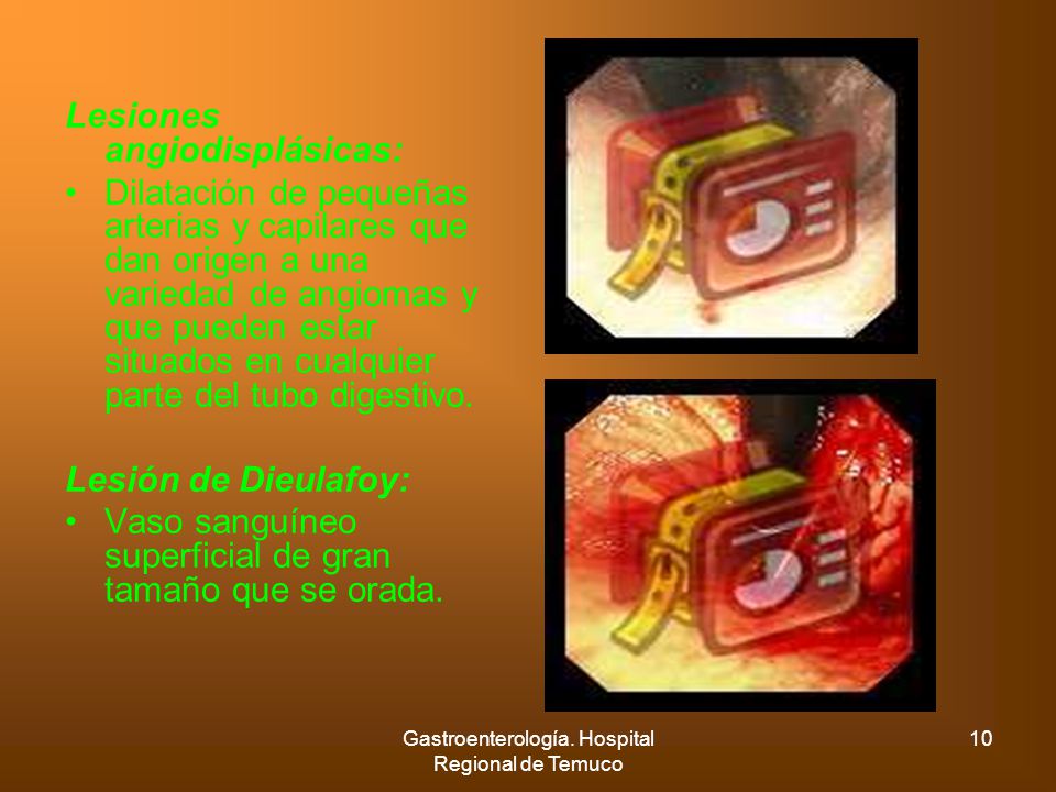 Gastroenterología. Hospital Regional de Temuco