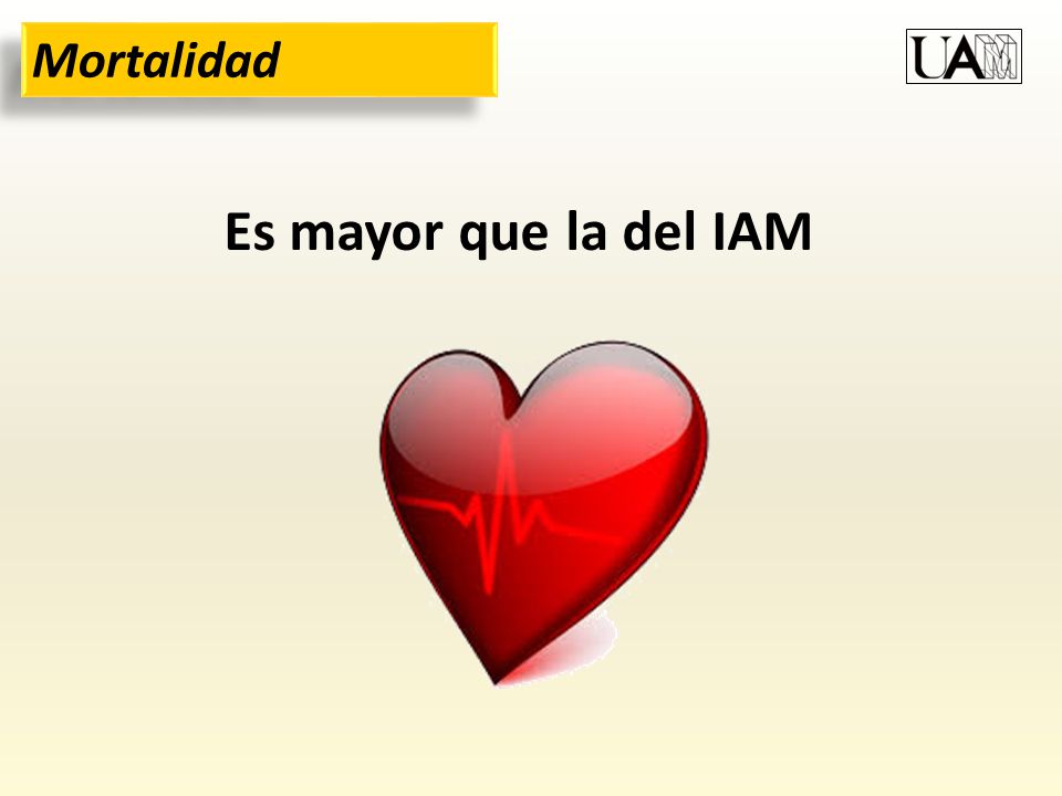 Mortalidad Es mayor que la del IAM