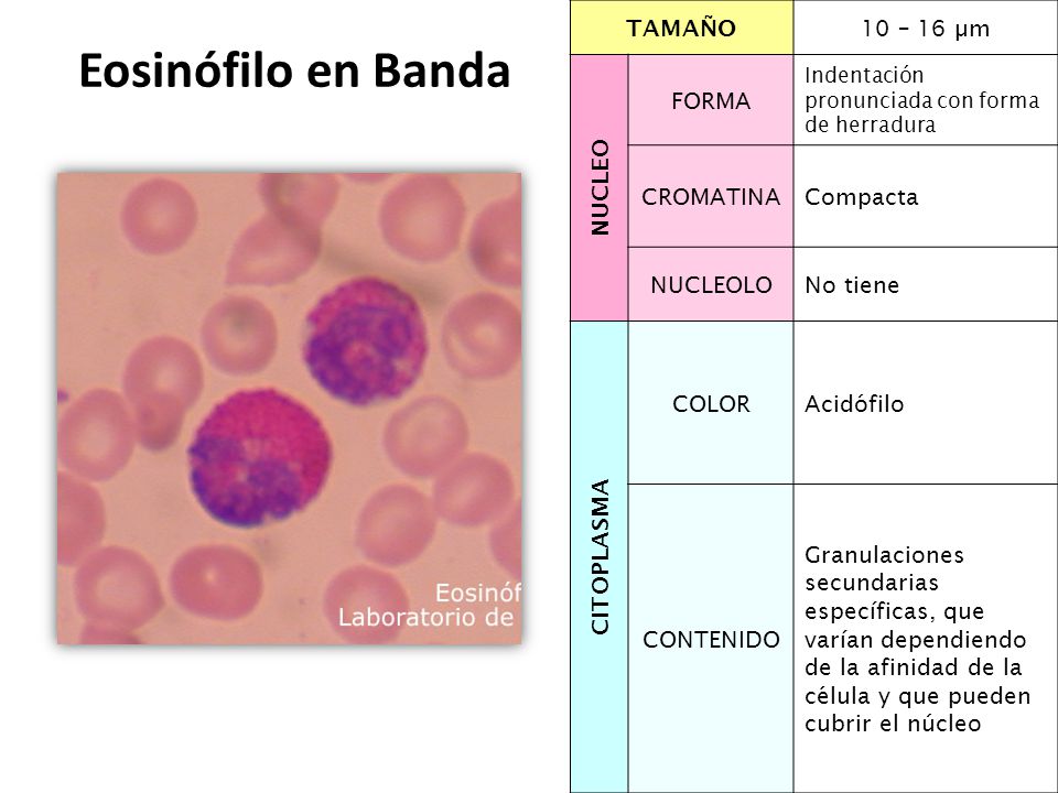 Eosinófilo en Banda TAMAÑO 10 – 16 µm NUCLEO FORMA CROMATINA Compacta