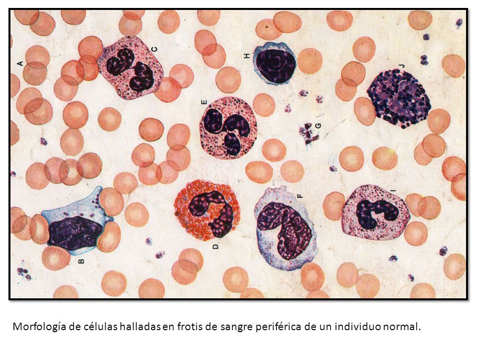 Morfología de células halladas en frotis de sangre periférica de un individuo normal.