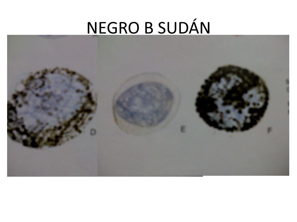 NEGRO B SUDÁN En la Diapositiva vemos tres células marcadas como D, E, F. D = Monocito ( vemos que está levemente teñido por el negro sudán)