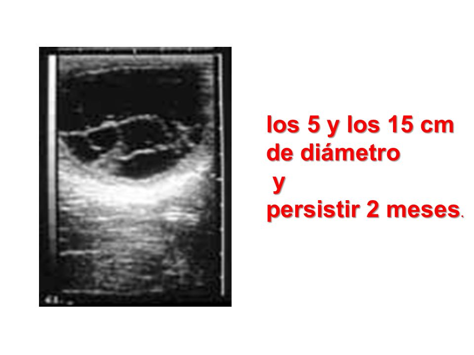 los 5 y los 15 cm de diámetro y persistir 2 meses.