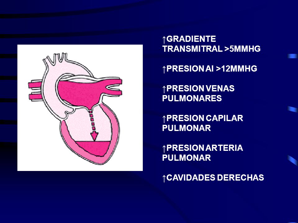 ↑GRADIENTE TRANSMITRAL >5MMHG. ↑PRESION AI >12MMHG. ↑PRESION VENAS. PULMONARES. ↑PRESION CAPILAR.
