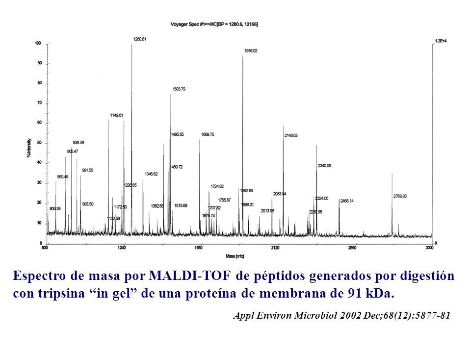 Espectro de masa por MALDI-TOF de péptidos generados por digestión con tripsina in gel de una proteína de membrana de 91 kDa.