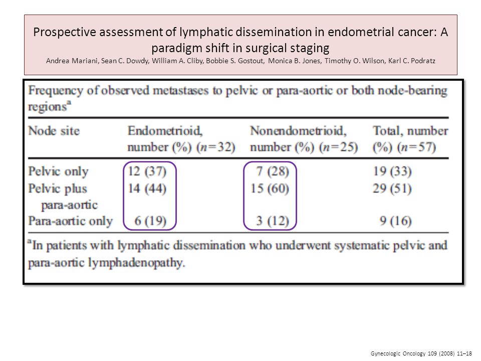 Prospective assessment of lymphatic dissemination in endometrial cancer: A paradigm shift in surgical staging Andrea Mariani, Sean C. Dowdy, William A. Cliby, Bobbie S. Gostout, Monica B. Jones, Timothy O. Wilson, Karl C. Podratz