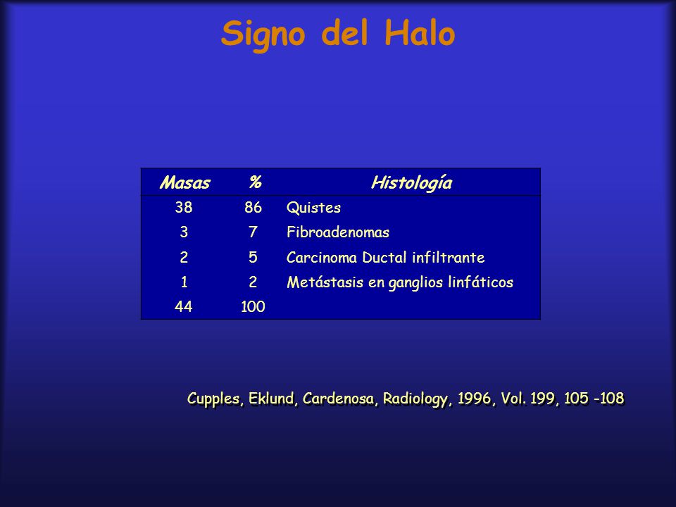 Signo del Halo Masas % Histología Quistes 3 7 Fibroadenomas 2 5