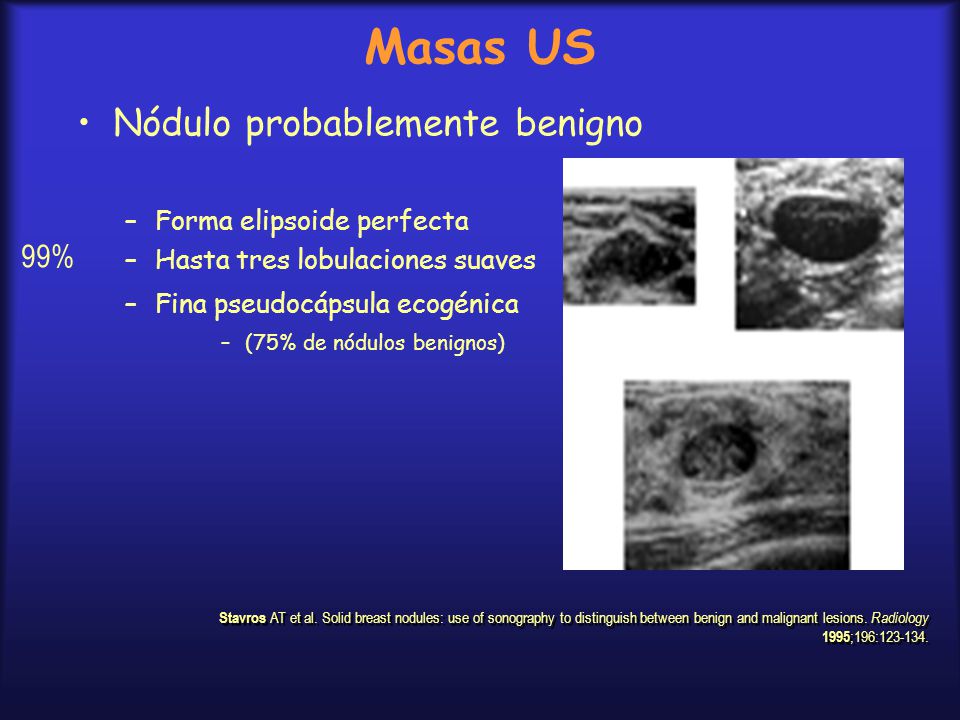 Masas US Nódulo probablemente benigno 99% Forma elipsoide perfecta