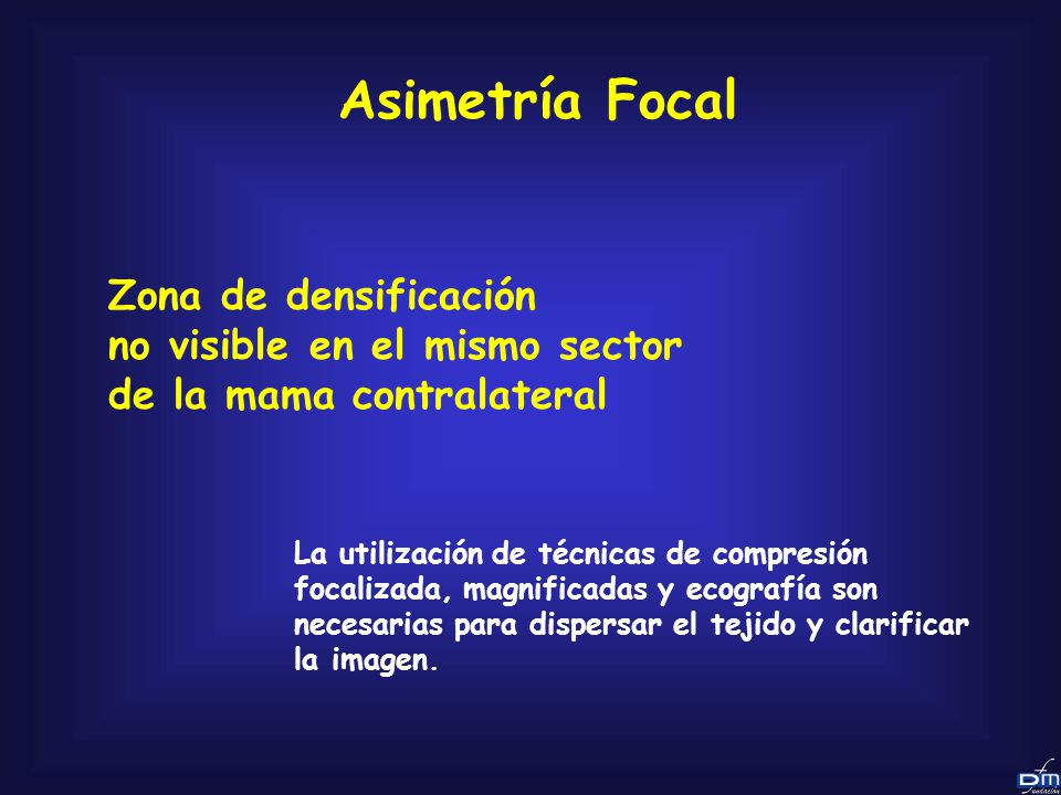 Asimetría Focal Zona de densificación no visible en el mismo sector de la mama contralateral.