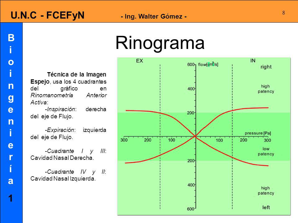 Rinograma Técnica de la Imagen Espejo, usa los 4 cuadrantes del gráfico en Rinomanometría Anterior Activa: