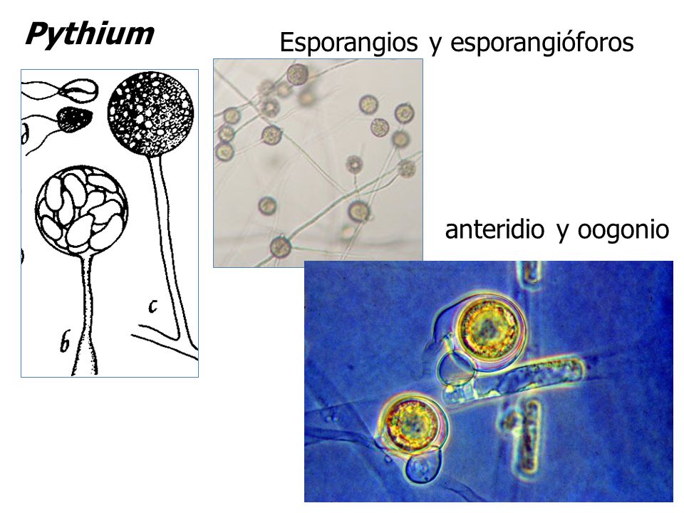 Pythium Esporangios y esporangióforos anteridio y oogonio