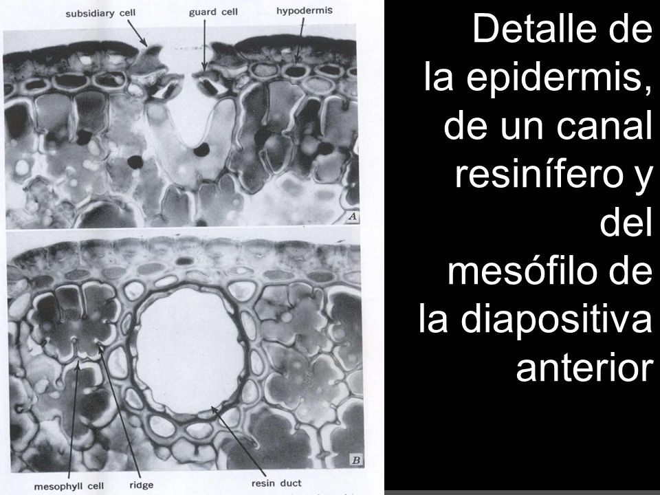 Detalle de la epidermis, de un canal resinífero y del mesófilo de la diapositiva anterior