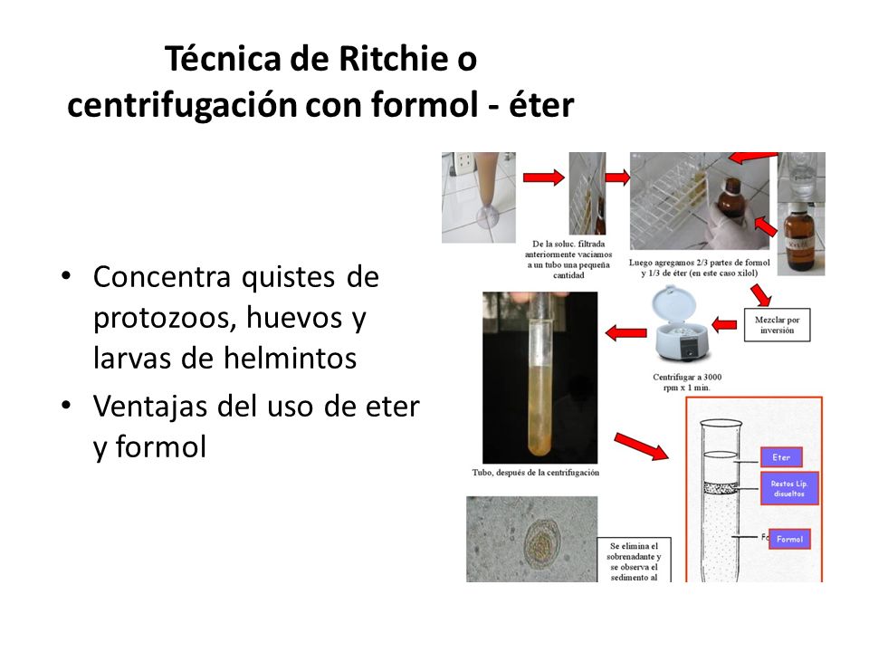 Técnica de Ritchie o centrifugación con formol - éter