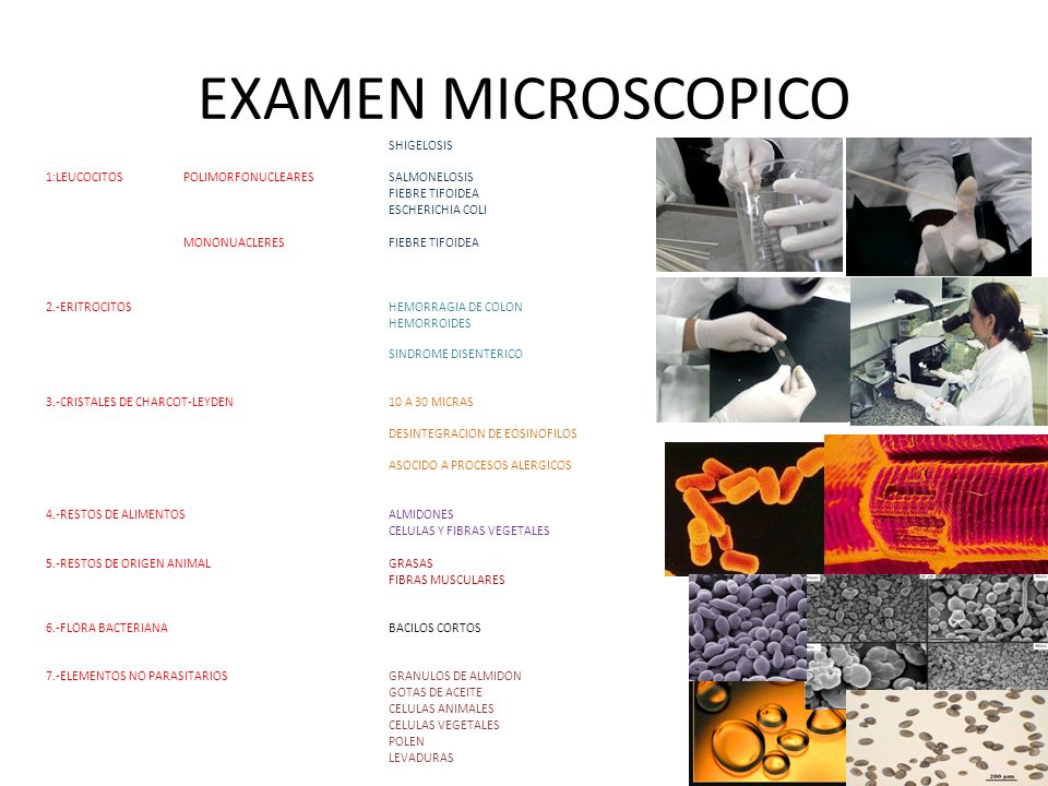 EXAMEN MICROSCOPICO SHIGELOSIS 1:LEUCOCITOS POLIMORFONUCLEARES