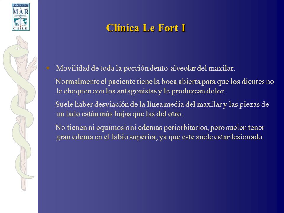 Clínica Le Fort I Movilidad de toda la porción dento-alveolar del maxilar.